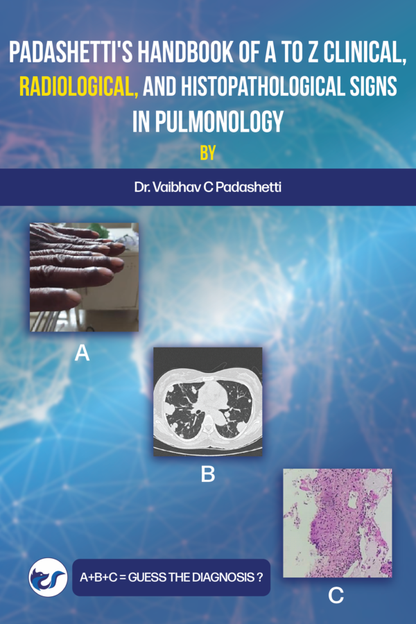 Padashetti’s Textbook on A to Z Signs in Pulmonology