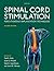 Spinal Cord Stimulation: Pe...
