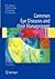 Common Eye Diseases and the...