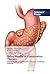 Safety Profile of Combination Therapy by Hemlata Dewangan