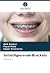 Selbstligierende Brackets: ...