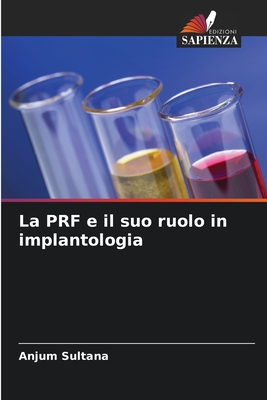 La PRF e il suo ruolo in implantologia (Italian Edition)