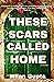 These Scars Called Home