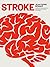 STROKE by Jean Pierre Wenger