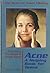 Everything You Need to Know About Acne: A Helping Book for Teens (Need to Know Library)