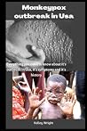 Monkeypox outbreak in Usa: Everything you need to know about it's outbreak in Usa, it's symptoms and it's history