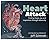 HEART ATTACK by Jeff Schmidt