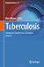 Tuberculosis: Integrated St...