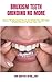 BRUXISM TEETH GRINDING NO MORE: Proven Remedy Guidelines To Knowledge And Treatments Options To Completely Thrive And Prevent Bruxism Teeth Grinding Without Striving Your Life