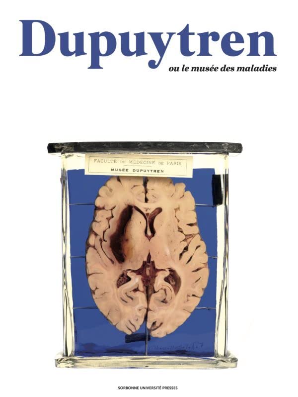 Dupuytren: ou le musée des maladies (Paperback)