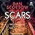 Scars