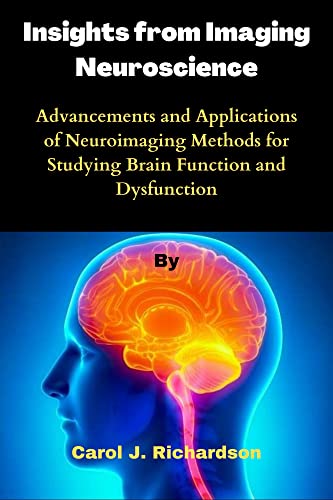 Insights from Imaging Neuroscience: Advancements and Applications of Neuroimaging Methods for Studying Brain Function and Dysfunction (Kindle Edition)
