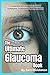 The Ultimate Glaucoma Book by Bert Middleton