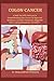 Colon Cancer: A Book that Will Assist you in Comprehending Colon Cancer, Its Signs and Symptoms, Available Treatments, Suggested Diets, Coping Mechanisms, And More!.