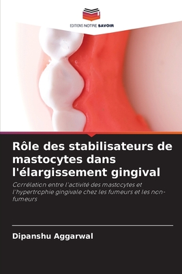 Rôle des stabilisateurs de mastocytes dans l'élargissement gingival (French Edition)