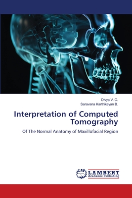 Interpretation of Computed Tomography: Of The Normal Anatomy of Maxillofacial Region