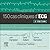 150 Cas Cliniques d'Ecg