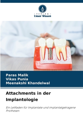 Attachments in der Implantologie: Ein Leitfaden für Implantate und implantatgetragene Prothesen (German Edition)