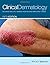 Clinical Dermatology