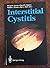 Interstitial Cystitis by Philip M., M.D. Hanno (1990-07-03)