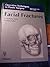 Facial Fractures by S. Anthony Wolfe