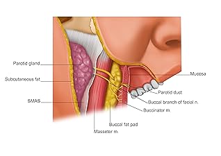 Remote Anchorage Solutions for Severe Maxillary Atrophy: Zygomatic Implants, Pterygoid Implants, Transnasal Implants, Piriform Rim Implants, Nasopalatine Implants, and Trans-Sinus Dental Implants