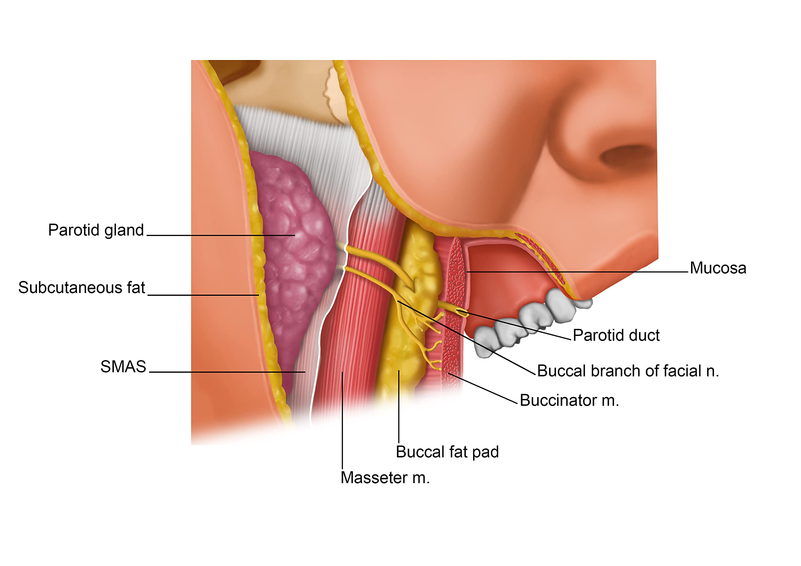 Remote Anchorage Solutions for Severe Maxillary Atrophy: Zygomatic Implants, Pterygoid Implants, Transnasal Implants, Piriform Rim Implants, Nasopalatine Implants, and Trans-Sinus Dental Implants (Textbook Binding)