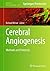 Cerebral Angiogenesis: Methods and Protocols (Methods in Molecular Biology) (2014-02-09)