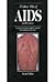 A Colour Atlas of AIDS: And HIV Disease