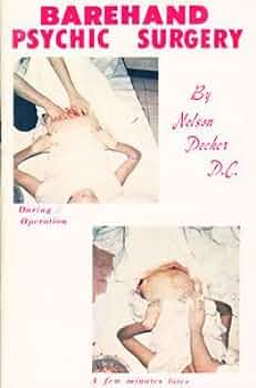 Barehand Psychic Surgery (Paperback)