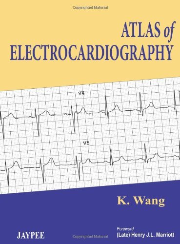 Atlas of Electrocardiography by K Wang (2013-03-31)