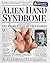Alien Hand Syndrome by Alan Bellows (2009-07-10)