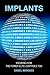 Implants: Knowing How the Power Elite Controls You by Daniel Marques (2012-11-16)