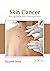 Skin Cancer: Recognition an...