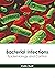 Bacterial Infections: Epide...