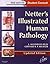 Netter's Illustrated Human Pathology Updated Edition: with Student Consult Access, 1e by L. Maximilian Buja MD (2013-10-24)