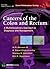 Cancers of the Colon and Rectum: A Multidisciplinary Approach to Diagnosis and Management (Current Multidisciplinary Oncology) (2013-10-30)