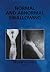 Normal And Abnormal Swallowing by Jones B.