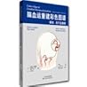 Color Atlas of cerebral revascularization: anatomy. tips and case (abroad) (in Chinese) [Paperback](Chinese Edition)