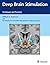 Deep Brain Stimulation: Techniques and Practices