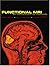 Functional MRI: An Introduction to Methods (1905-07-09) [Paperback]