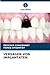 Versagen Von Implantaten by Deeksha Chaudhary