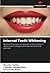 Internal Teeth Whitening: S...