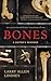 Bones