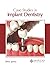 Case Studies in Implant Den...