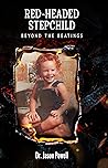 RED-HEADED STEPCHILD by Dr. Jason Powell