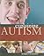Explaining Autism
