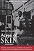 Acres of Skin: Human Experiments at Holmesburg Prison : A True Story of Abuse and Exploitation in the Name of Medical Science by Allen M Hornblum