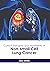Current Therapies and Treatments of Non-small Cell Lung Cancer by Rex White