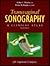 Transvaginal Sonography by Arthur C. Fleischer